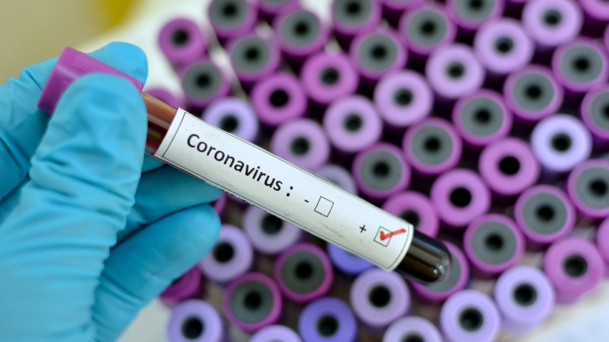 Названы регионы, где выявили новые случаи заражения коронавирусом